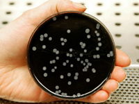 AN42-5-spotlight-legionnaires disease